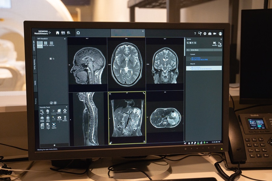Ezra launches AI-powered full-body MRI cancer screening in the UK 