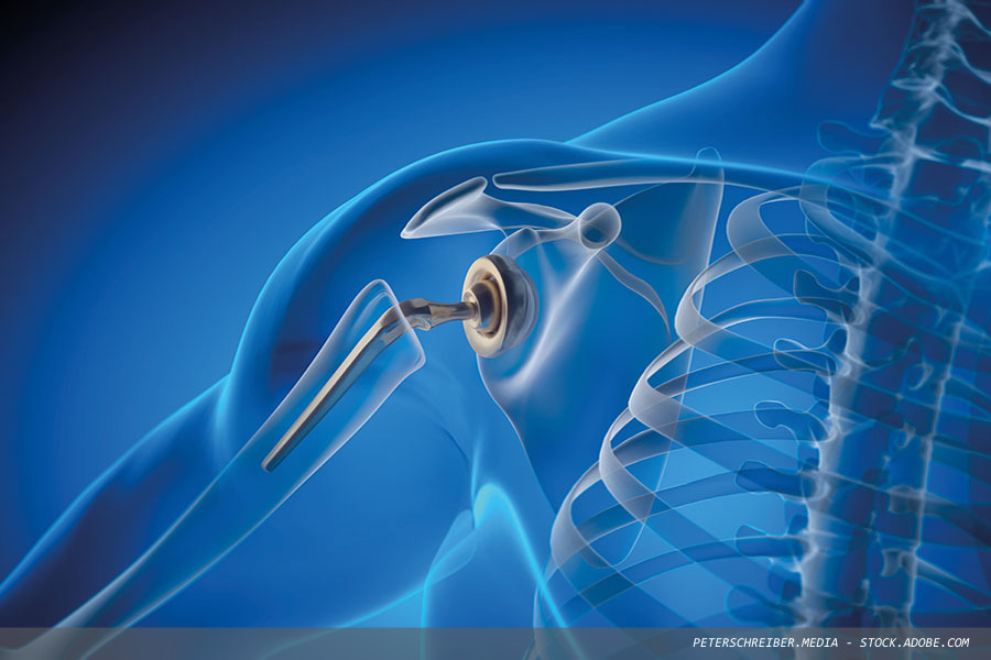Why health registry data is critical to patient safety