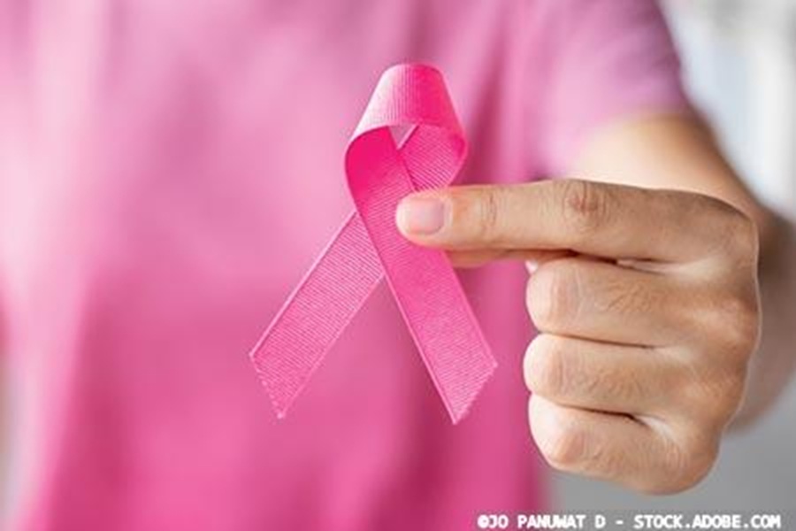 AI-supported mammography screening results in fewer aggressive and advanced breast cancers