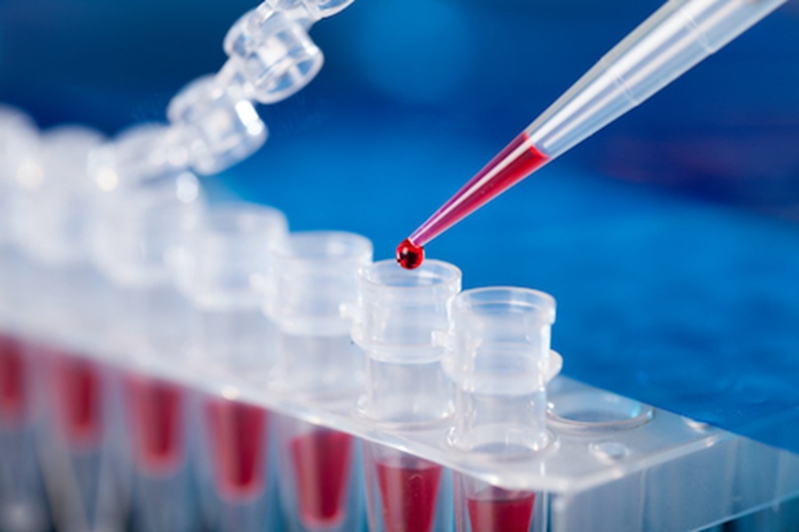 Early signs of Parkinson’s can be identified in the blood