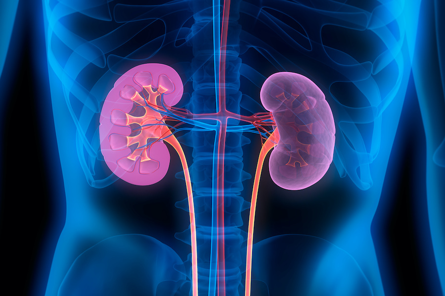 One in five kidney cancer patients now diagnosed at stage 4