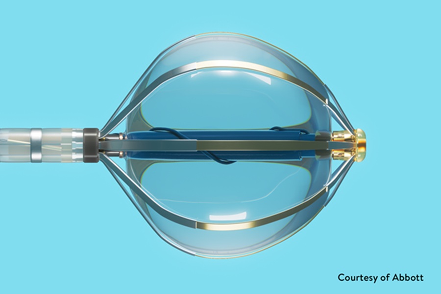 NHS Hospitals pilot pioneering ablation system 