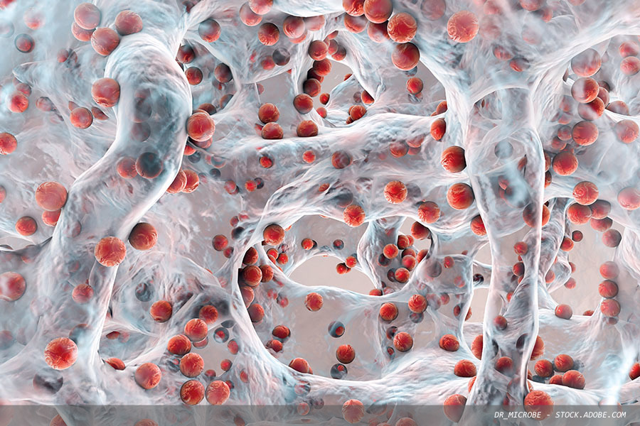 Vital role of disinfection in tackling AMR