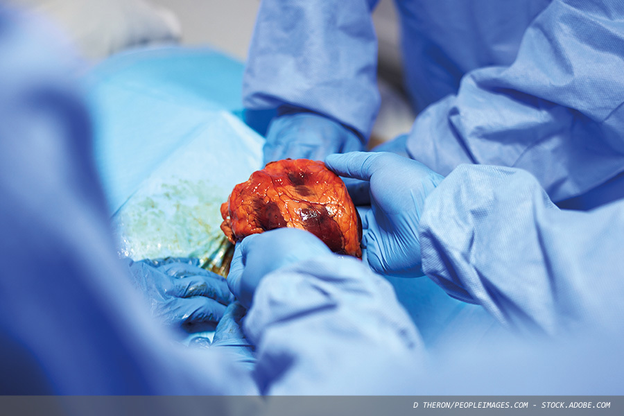 Making organ donation expected