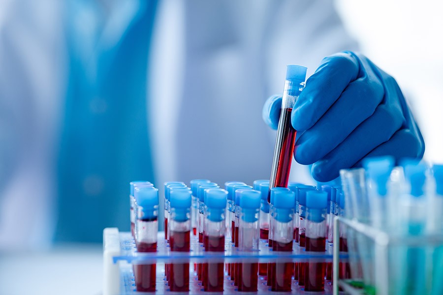 Blood protein signature can predict lung cancer risk years earlier