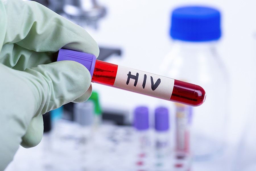 NHS A&E blood-testing finds 2,000 unidentified HIV cases in first 4 years